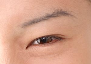 オーダーメイドの美容整形ならここ